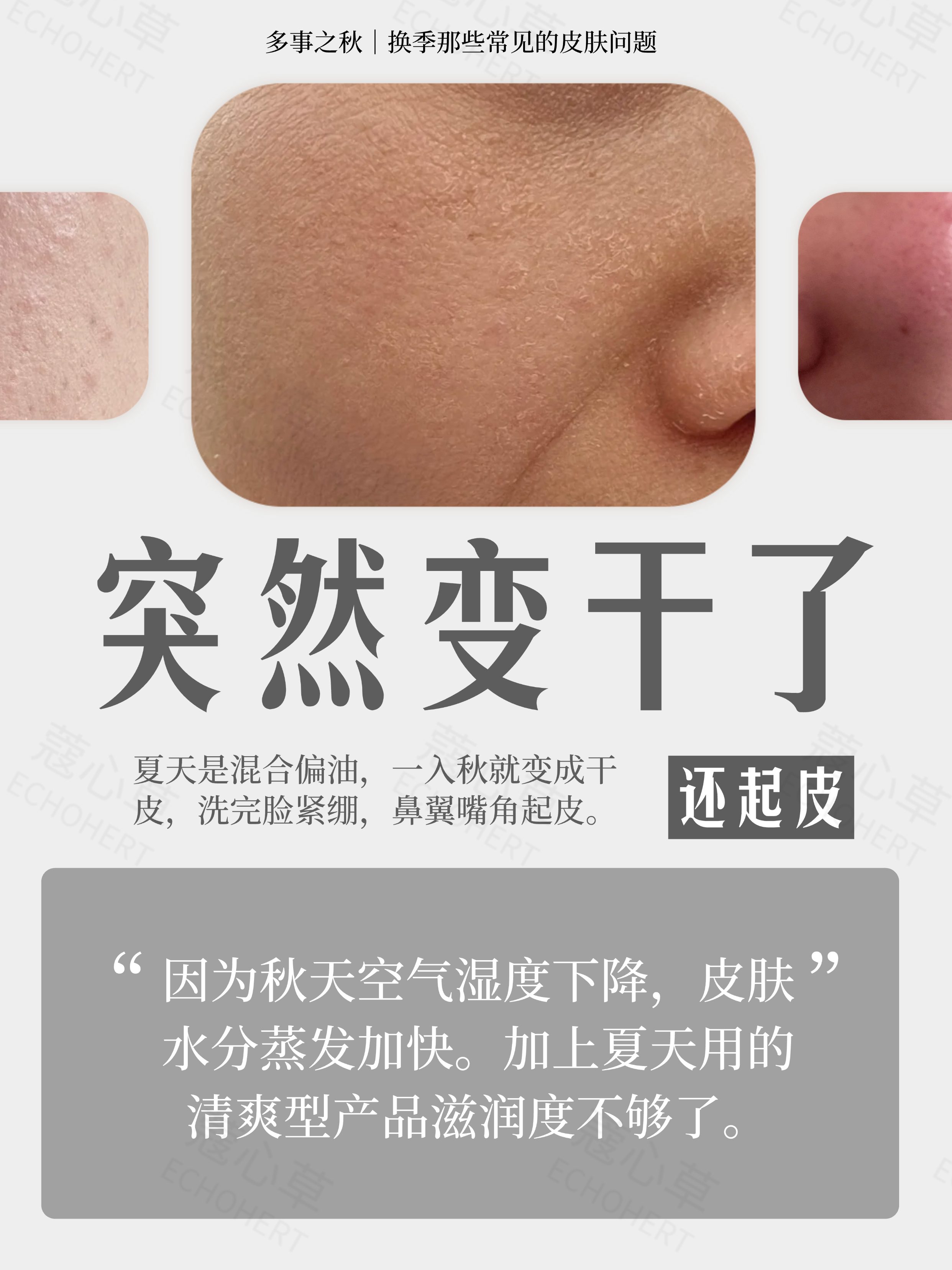 夏秋换季，秋天皮肤变差1.jpg