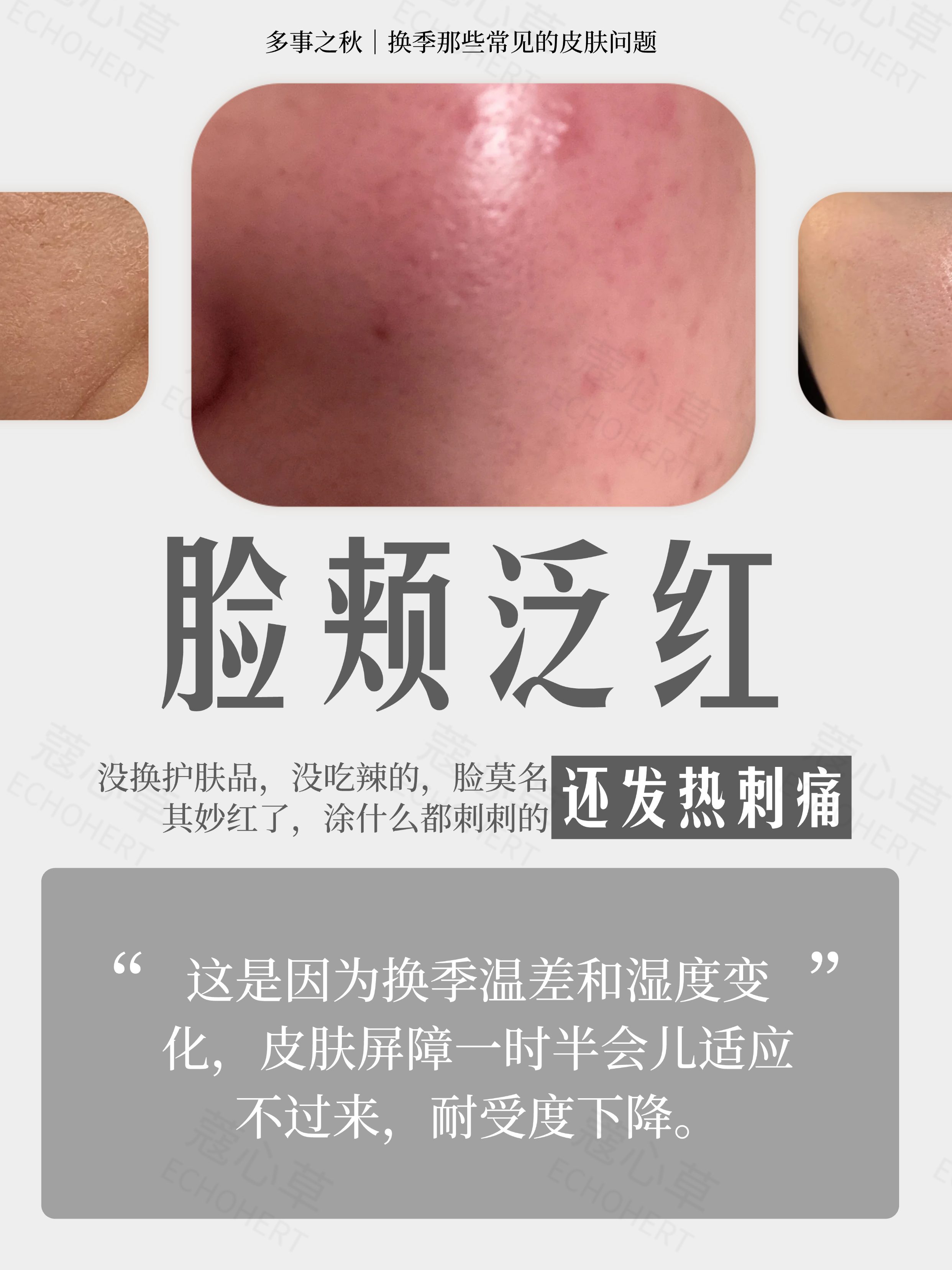 夏秋换季，秋天皮肤变差2.jpg