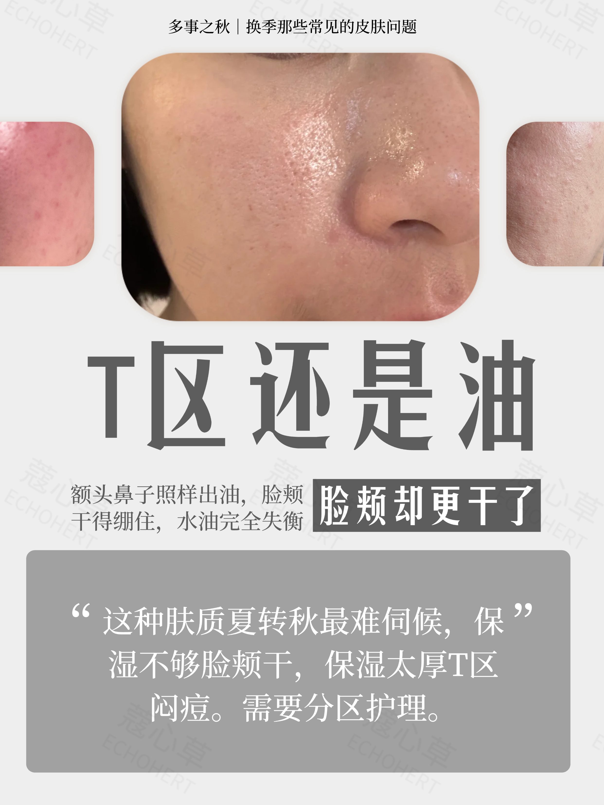夏秋换季，秋天皮肤变差3.jpg